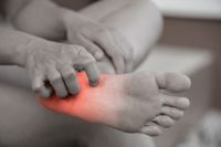 Symptoms, Causes, and Care of Foot Neuropathy
