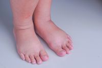 Understanding the Causes of Foot Pain During Pregnancy