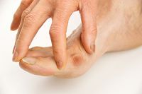 Is There Relief for Bunions?