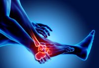 Recognizing Early Signs of Foot Arthritis