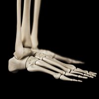 Treatment for Stress Fractures